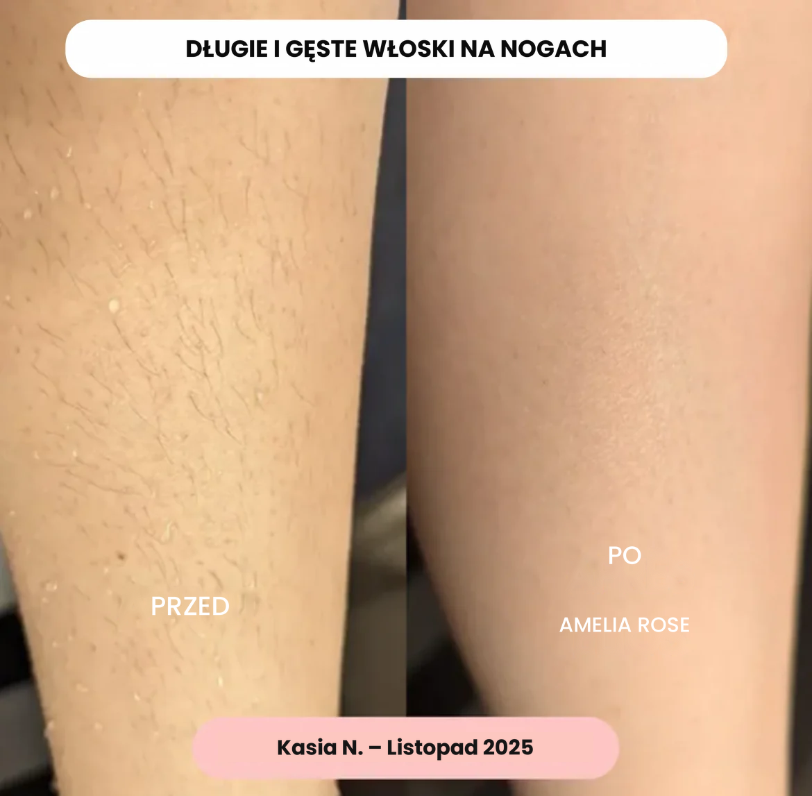 Golarka 5w1 do całego ciała – Amelia Rose™